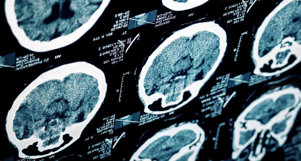 lander bigdata4brain