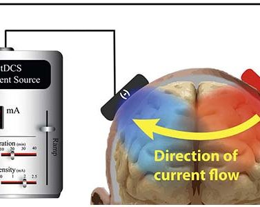 what is tdcs current flow